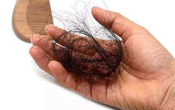 男性脱发怎么办 男性脱发严重怎么办 四个快速生发的方法