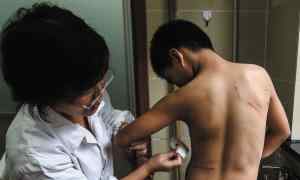 被兔子抓伤了要打疫苗吗 杭州犬伤门诊门庭若市 被猫咪挠伤也得打疫苗