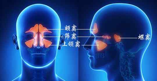 鼻炎引起头痛的位置 这7种方法，治疗鼻窦炎引起的【头痛】