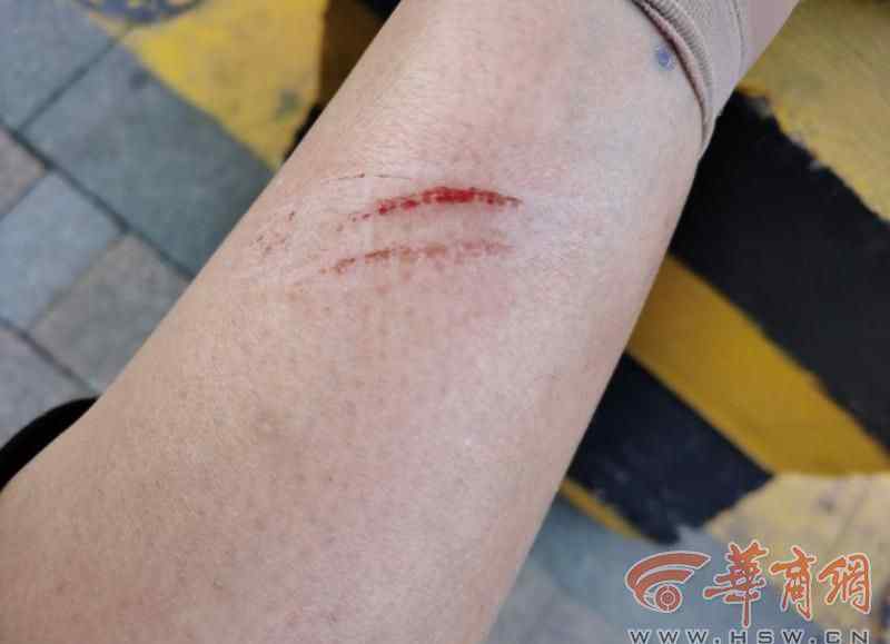 西安华城国际 太危险了！西安华城国际小区楼体瓷片掉落砸伤业主