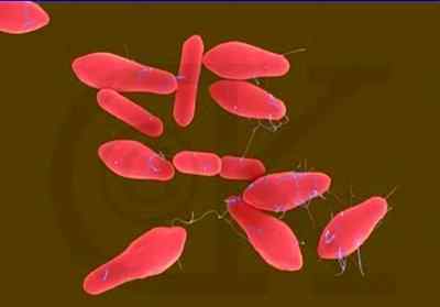 肉毒杆菌是什么东西 食品中的肉毒杆菌很脆弱？芽孢想弄死不容易