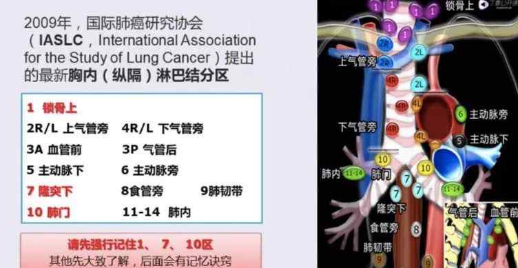 肺ct 如何优雅的解读肺部 CT ?